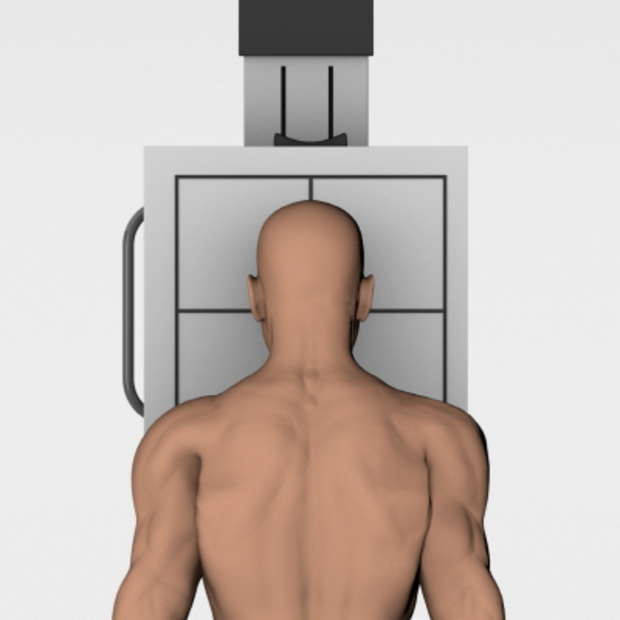 Facial bone PA 15 Caldwell view radiography positioning image